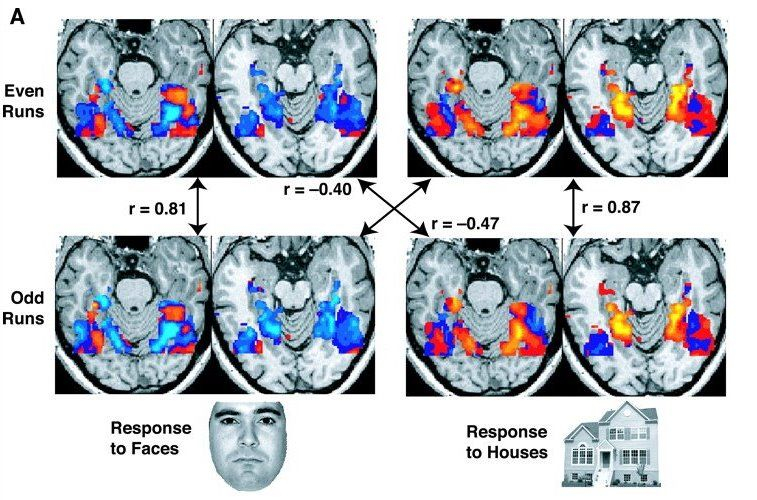 Neuromarketing (Nöro Pazarlama) Araştırma Teknikleri 5 Neuromarketing - Nöro Pazarlama Nedir?